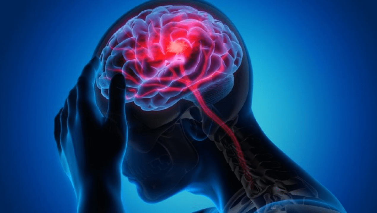 Pria Stroke usai Bersin Keras